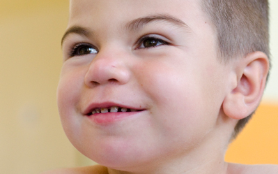 Izmainīti sejas vaibsti var liecināt par retu slimību