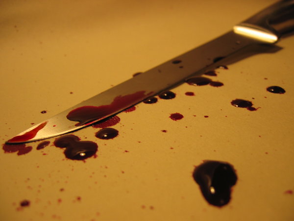 Tukumā ievainots vīrietis pēc palīdzības vēršas veikalā