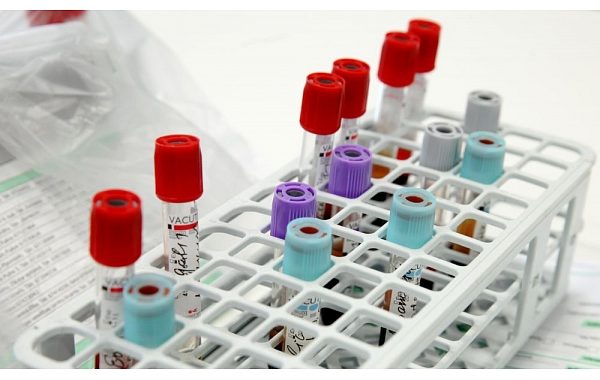 Turpmāk informāciju par COVID-19 negatīviem rezultātiem iedzīvotāji saņems E-veselības portālā