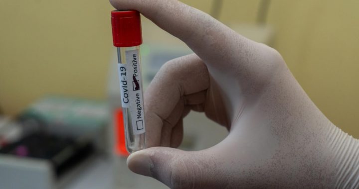 Kur palikuši testi? /PAPILDINĀTS/