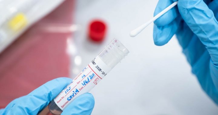 Jautājumi un atbildes par testēšanos un rezultātu saņemšanu