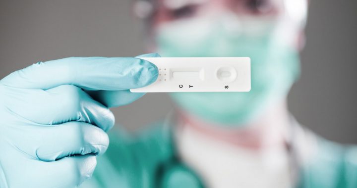 Kāpēc pēc analīzēm tik garas rindas?