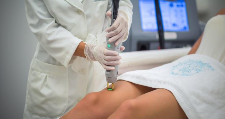 Uzzini, kā notiek matiņu noņemšana ar lāzeru