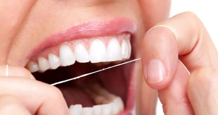 Iegūsti satriecošu smaidu ar profesionāļu palīdzību