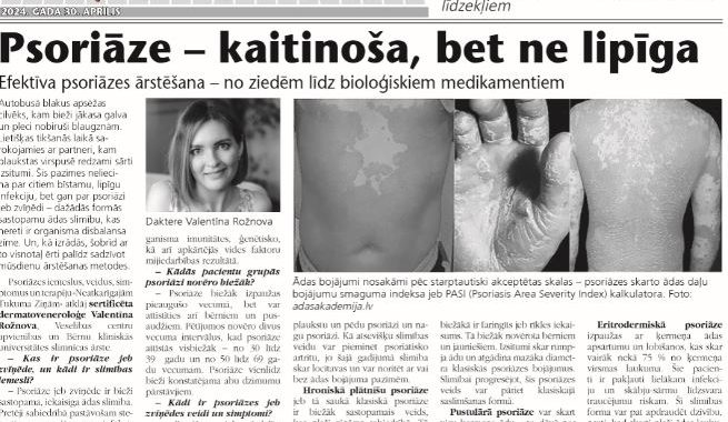 Psoriāze – kaitinoša, bet ne lipīga