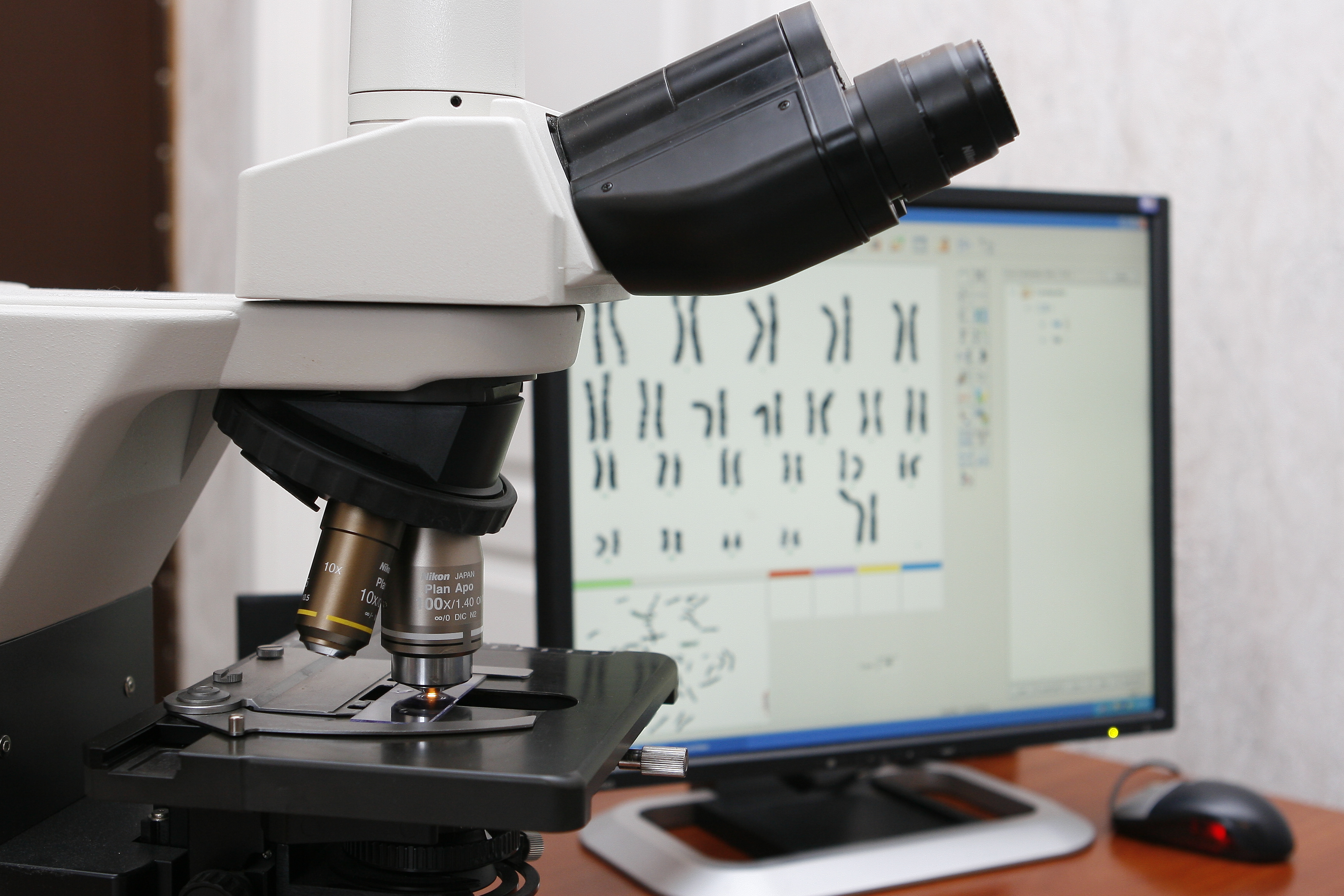 Prenatālās diagnostikas nodaļa – Bērnu klīniskās universitātes slimnīcā